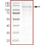 EGFR (d746-750), Active with mCherry